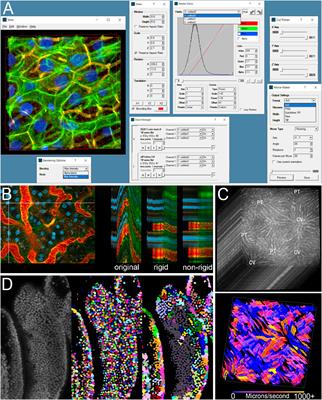 Digital Image Analysis Tools Developed by the Indiana O’Brien Center